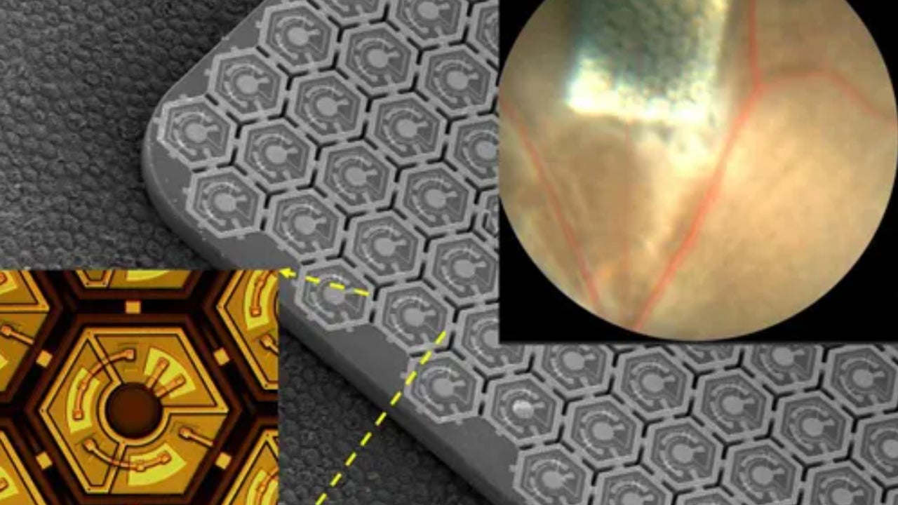 A retinal prosthesis provides artificial vision to blind mice