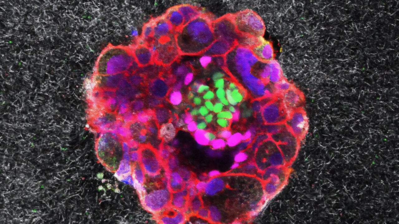 Spanish scientists record, for the first time the exact moment of human embryo implementation