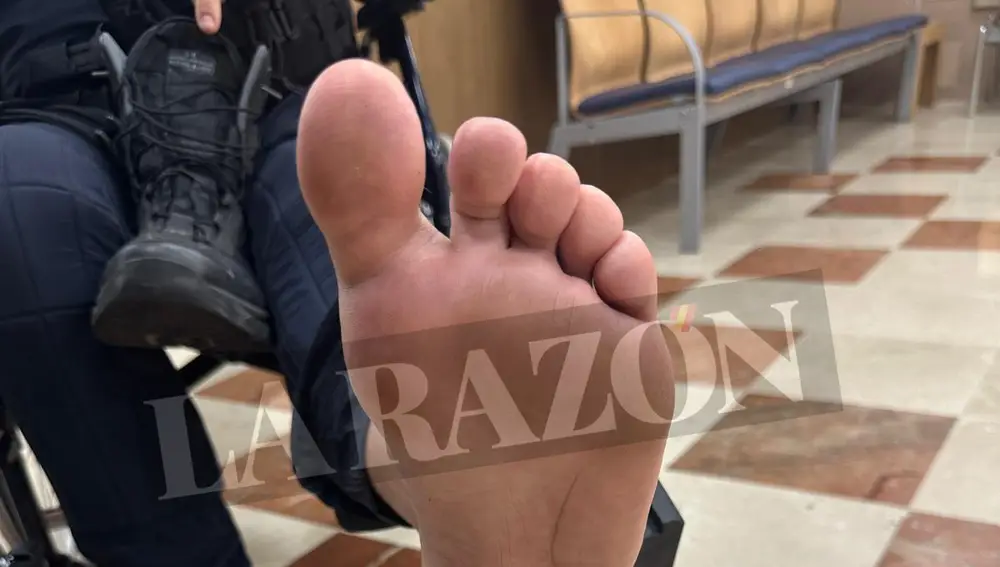 The wounds of the riots in the incidents of the Vuelta in Madrid