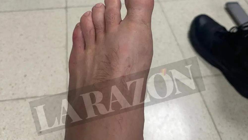 The wounds of the riots in the incidents of the Vuelta in Madrid