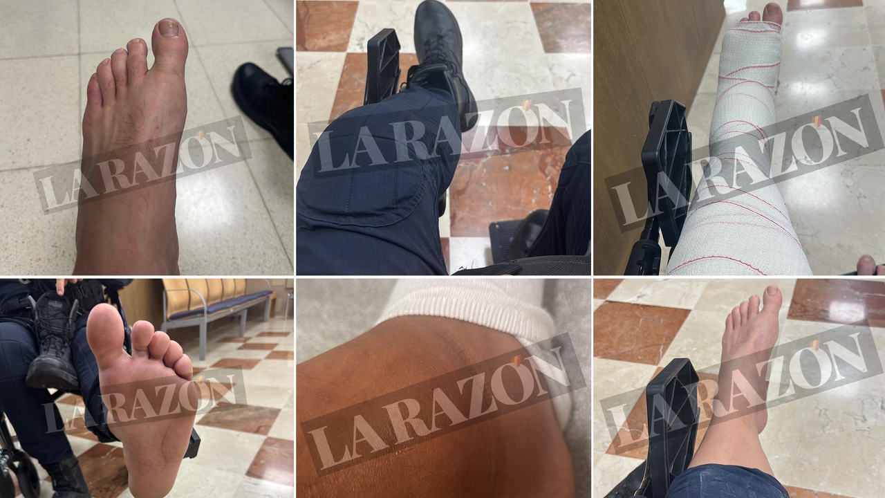 The wounds of the riots in the incidents of the Vuelta in Madrid