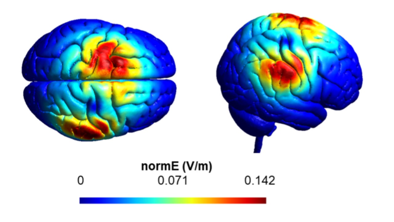 They hack the brain to make us more generous
