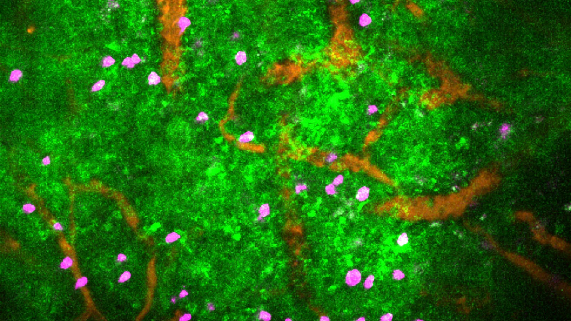 Scientists create immune cells that fight cancer