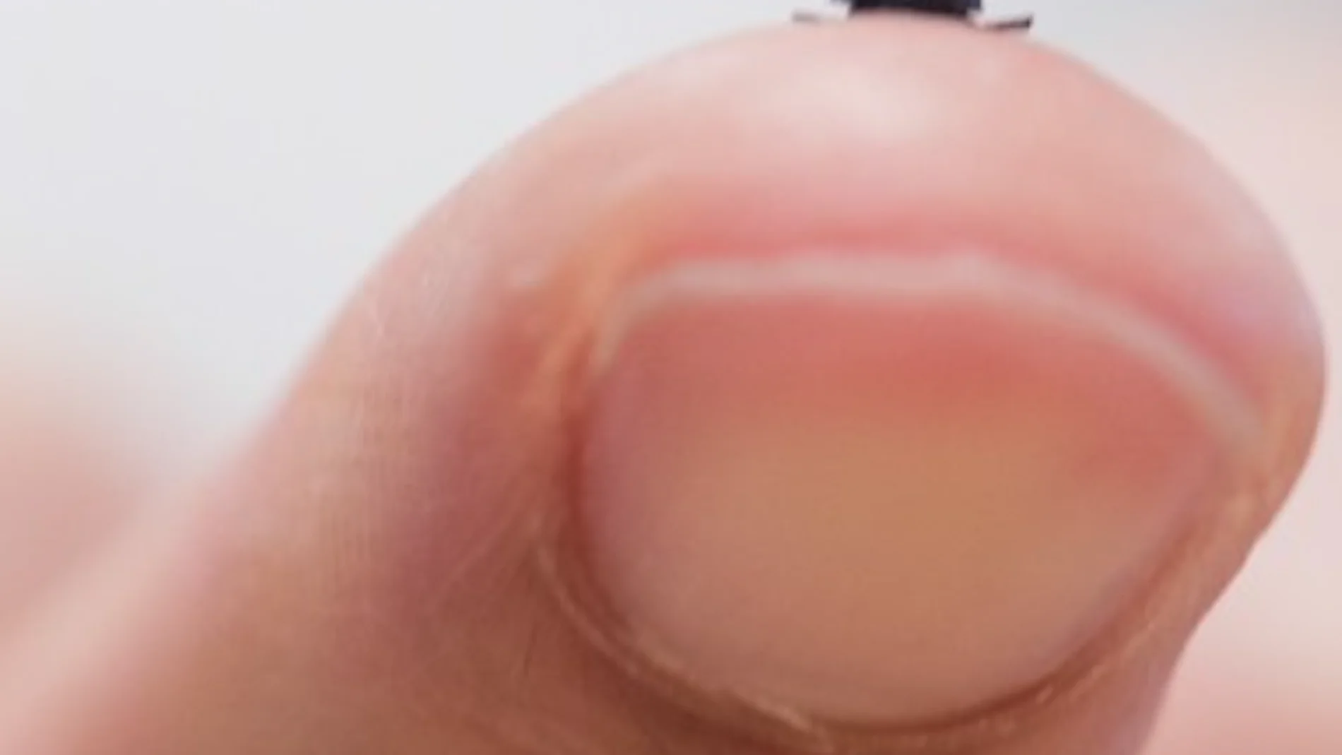 This seed-sized robot has the potential to revolutionize surgery